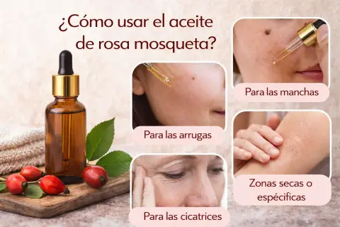 Aceite de rosa mosqueta: ideal para arrugas, manchas, cicatrices y zonas secas.