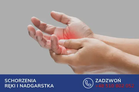 Dłoń z zaczerwienieniem na palcu, wskazującym na zapalenie pochewki ścięgna zginacza palca. Leczenie schorzeń ręki i nadgarstka.