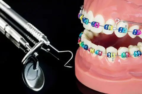 Kolorowy aparat na zgryz krzyżowy na modelach zębów, obok narzędzi dentystycznych.