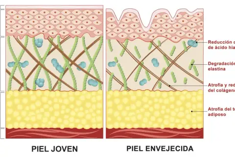 Comparación de piel joven y envejecida, mostrando la degradación de la elastina y la reducción de colágeno en la piel madura.