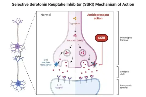 Mechanizm działania SSRI, jak Depralin. Blokada transportera serotoniny zwiększa jej dostępność w synapsie, poprawiając nastrój.