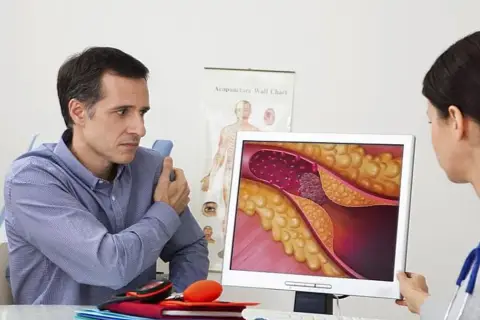 Lekarz pokazuje pacjentowi obraz zwężonej tętnicy, sugerując leczenie, np. walsartanem, dla poprawy krążenia.