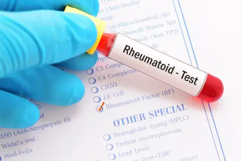 Rękawiczka w niebieskiej rękawiczce trzyma probówkę z napisem "Rheumatoid - Test". Zaznaczono "Rheumatoid Factor (RF)", co sugeruje, że to badanie na obecność czynnika reumatoidalnego.