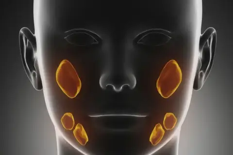 Anatomia twarzy z zaznaczonymi śliniankami. Widoczne są gruczoły przyuszne nad żuchwą i podżuchwowe pod nią.