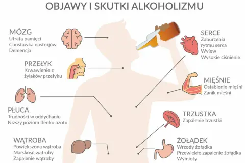 Ilustracja pokazuje skutki alkoholizmu: uszkodzenia mózgu, serca, płuc, wątroby, żołądka, trzustki i mięśni.
