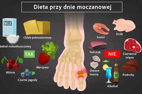 Dieta przy dnie moczanowej: TAK - nabiał, warzywa, owoce. NIE - czerwone mięso, podroby, alkohol. Milurit co to za lek? Zapytaj lekarza.
