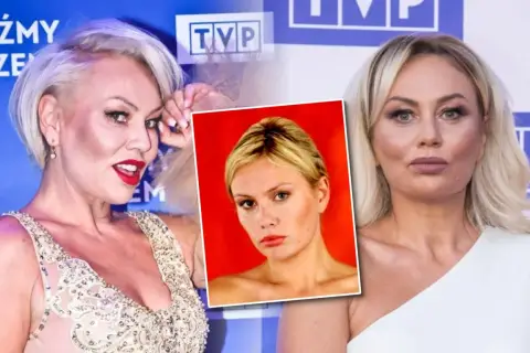 Monika Jarosińska w porównaniu do zdjęć z przeszłości, gdzie widać jej męża, prezentuje się po operacjach plastycznych.