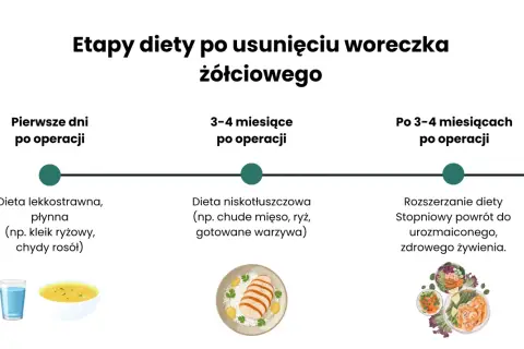 Jadłospis tygodniowy po usunięciu woreczka żółciowego: etapy diety - lekkostrawna, niskotłuszczowa, rozszerzona.