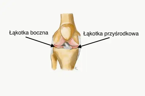 Anatomia kolana z zaznaczoną łąkotką boczną i przyśrodkową.