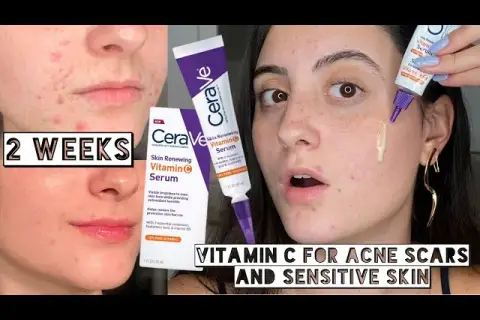 CeraVe Vitamin C Serum: Vorteile, Anwendung und echte Erfahrungen