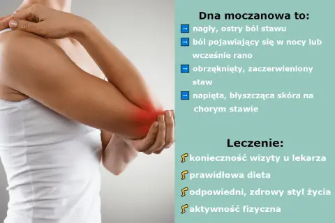 Dna moczanowa objawia się nagłym, ostrym bólem stawu, obrzękiem i zaczerwienieniem. Leczenie obejmuje wizytę u lekarza, dietę i zdrowy styl życia.