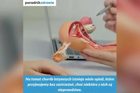 Model anatomiczny narządów rodnych kobiety, omawiający choroby intymne, w tym pęcherzycę.