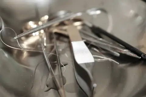Pinces chirurgicales et fils de suture dans un plateau métallique. Un fil semble détaché, évoquant un point de suture qui a sauté après une circoncision.