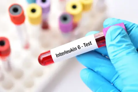 Ręka w niebieskiej rękawiczce trzyma probówkę z krwią do testu na interleukinę 6. Cytokiny co to? To białka sygnałowe układu odpornościowego.