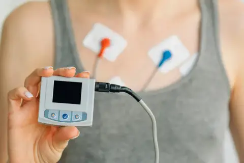 Holter co to? Urządzenie do monitorowania pracy serca z elektrodami na klatce piersiowej i małym rejestratorem w dłoni.