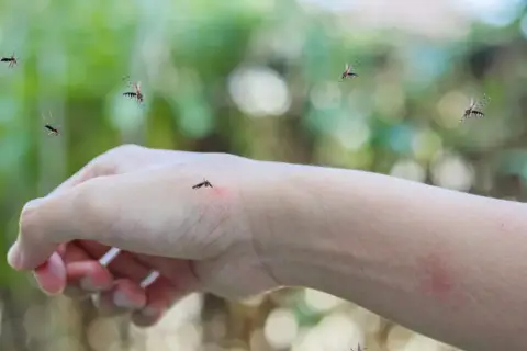 Komary krążą wokół ręki, na której widać zaczerwienienie po ugryzieniu. Szukasz co na ugryzienie komara?