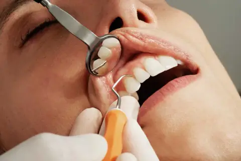 Esame dentale per valutare l'infiammazione impianto dentale e i possibili rimedi.
