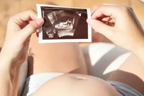 Kobieta trzyma zdjęcie USG, na którym widać zarodek. To nie lewatywa, a cud życia.