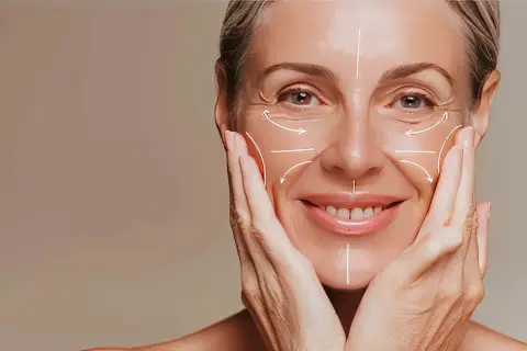 Volto di donna con linee bianche che indicano le rughe nasogeniene e altre zone del viso, mani che accarezzano le guance.