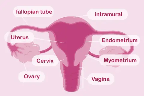 Schemat kobiecych narządów rozrodczych: jajniki, jajowody, macica z endometrium i mięśniówką, szyjka macicy i pochwa.