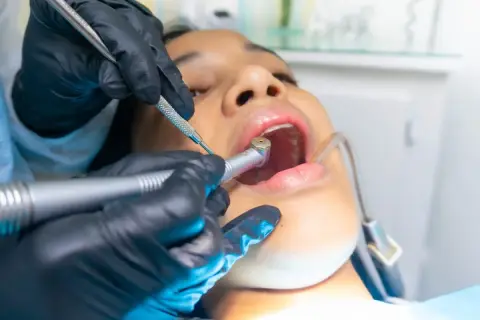Dentysta wykonuje zabieg leczenia kanałowego. Czas leczenia kanałowego zależy od wielu czynników.