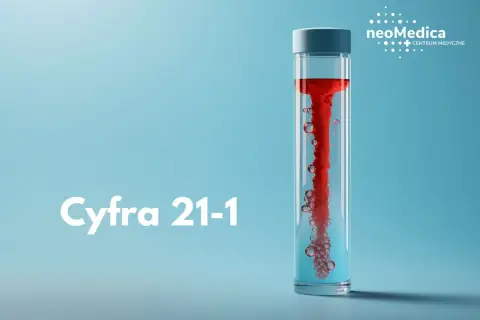 Cyfra 21-1: czerwona ciecz wiruje w probówce, tworząc pęcherzyki. Logo NeoMedica Centrum Medyczne.