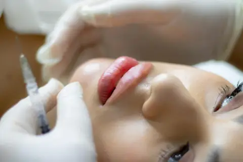 Primo piano di labbra e occhio durante un trattamento estetico. Evitare i 15 peggiori errori della chirurgia estetica.