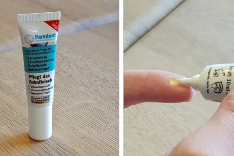 Parodont Zahnfleischpflege-Gel: eine mögliche beste Salbe gegen Zahnfleischentzündung, mit Schwarzkümmelöl.