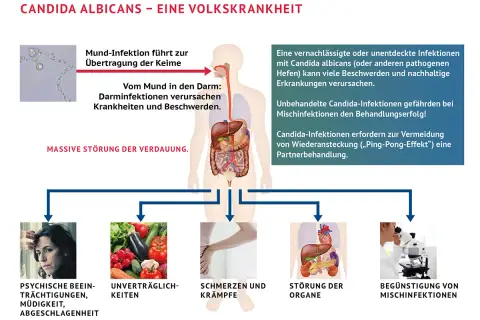 Psychische Belastung, Verdauungsprobleme, Schmerzen, Organstörungen und Mischinfektionen sind Symptome, wenn Candida abstirbt.
