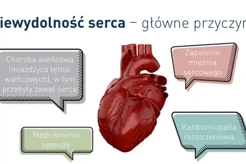 Anatomical heart with labels: choroba wieńcowa, zapalenie mięśnia sercowego, nadciśnienie tętnicze, kardiomiopatia rozstrzeniowa. Te czynniki mogą prowadzić do niewydolności serca.