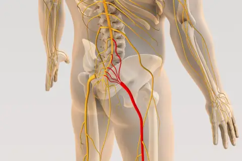 Anatomia układu nerwowego, z uwydatnionym czerwonym nerwem wskazującym na potencjalną przepuklinę kręgosłupa.