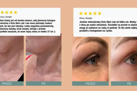 Pozytywne opinie o Oslo Skin Lab. Zdjęcia "przed" i "po" pokazują poprawę skóry. Kolagen idealny, wygodny w użyciu.