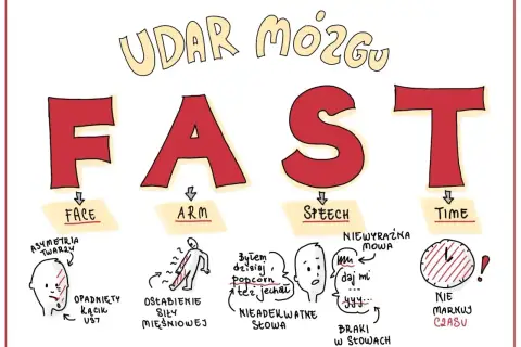 Objawy udaru mózgu: FAST. Asymetria twarzy, osłabienie siły mięśniowej, nieadekwatne słowa, braki w słowach, niewyraźna mowa, nie marnuj czasu. Czasownik to czynność, np. "daj mi".