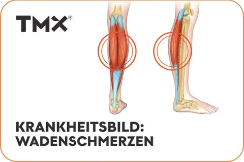 Anatomische Darstellung der Beinmuskulatur mit Hervorhebung der Wadenmuskeln. Rote Kreise markieren Bereiche, die auf **Schmerzen in der Wade** hinweisen könnten.
