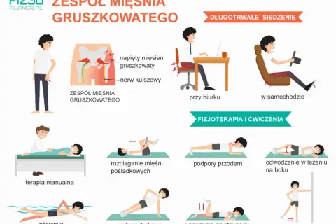Ilustracja pokazuje zespół mięśnia gruszkowatego, jego objawy i ćwiczenia fizjoterapeutyczne, takie jak rozciąganie, podpory i pływanie.