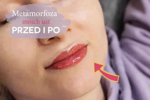 Metamorfoza moich ust przed i po. Czy makijaż permanentny ust boli? Efekt WOW!