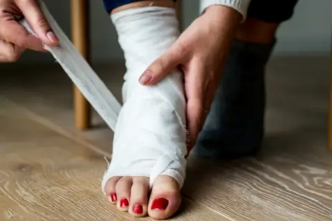 Osoba bandażuje stopę, co może być objawem skręconej kostki. Widoczne są palce z czerwonym lakierem.