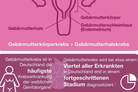 Symptome bei Gebärmutterkrebs: Warnzeichen, die Sie nicht ignorieren sollten