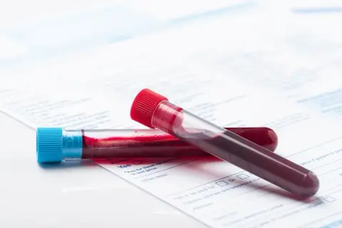 Anemia a psychika: Rozpoznaj objawy, odzyskaj spokój