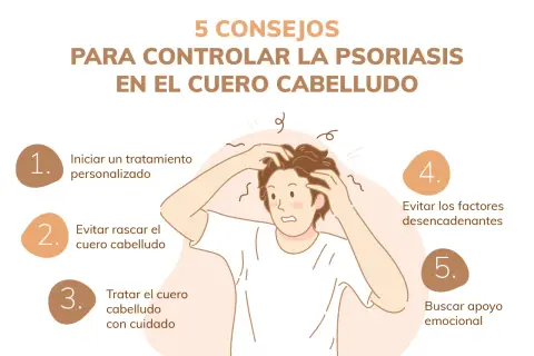 Consejos para controlar la psoriasis en el cuero cabelludo: tratamiento, evitar rascar, cuidado, desencadenantes y apoyo emocional.
