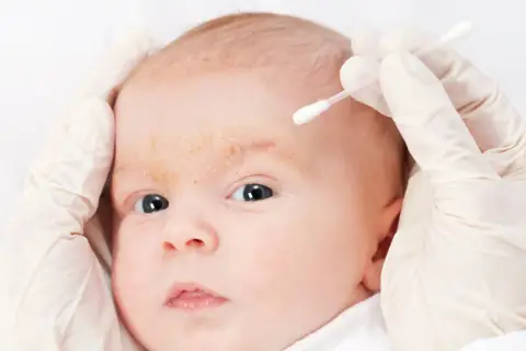 Delikatna pielęgnacja niemowlęcia z ciemieniuchą na brwiach. Rękawiczki i patyczek kosmetyczny pomagają w łagodzeniu.
