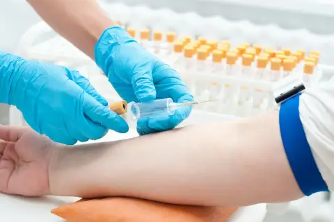 Pobieranie krwi do badań w kierunku insulinooporności. Ręka pacjenta z założonym stazą, pielęgniarka w rękawiczkach pobiera próbkę.