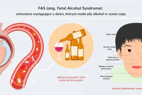 Ilustracja pokazuje płód w łonie matki, alkohol przechodzący do krwiobiegu płodu i cechy charakterystyczne dla zespołu FAS u noworodka.