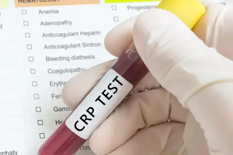 Ręka w rękawiczce trzyma probówkę z krwią do badania CRP TEST. Na tle widoczna lista badań, m.in. białko c reaktywne.