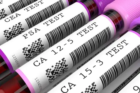 Zestaw badań markery nowotworowe: CEA, PSA, CA 12-5, CA 15-3. Sprawdź pakiet cena.