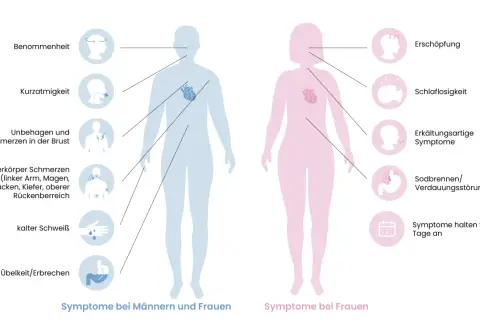 Männer: Benommenheit, Kurzatmigkeit, Brustschmerz, Oberkörperschmerzen, kalter Schweiß, Übelkeit. Symptome Herzinfarkt Männer erkennen.