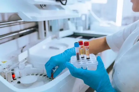 Ręce w niebieskich rękawiczkach trzymają probówki z krwią przy aparaturze laboratoryjnej.
