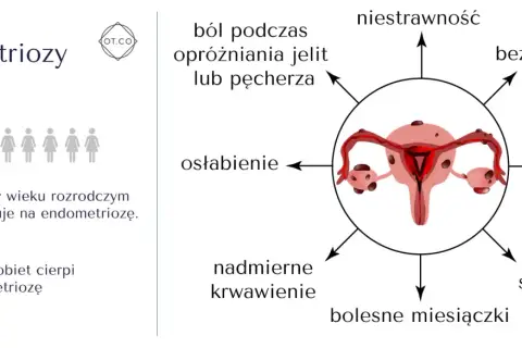 Ilustracja przedstawia objawy endometriozy: ból, niestrawność, bezpłodność, mdłości, bolesny stosunek, bolesne miesiączki, nadmierne krwawienie i osłabienie.