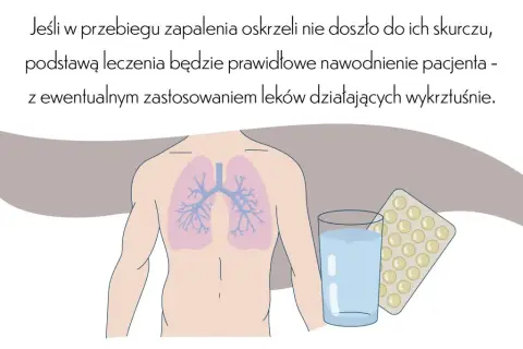 Leczenie zapalenia oskrzeli: Kiedy antybiotyk, a kiedy domowe sposoby?