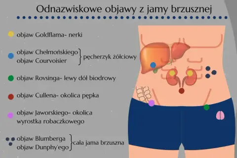 Objaw Chełmońskiego, wskazujący na pęcherzyk żółciowy, zaznaczony niebieską kropką na ilustracji jamy brzusznej.